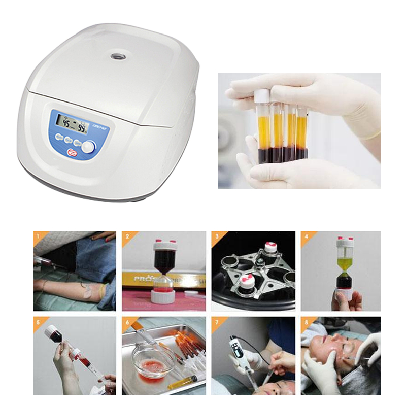 Medical Lab Center - Mesin Centrifuge Medis PRP PRF CGF